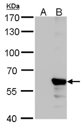 Anti-Influenza B virus Nucleoprotein antibody [GT382] used in Western Blot (WB). GTX629883
